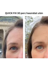 Nagora QUICK FIX szemkörnyékápoló azonnali b.o.t.o.x hatású peptiddel 15ml