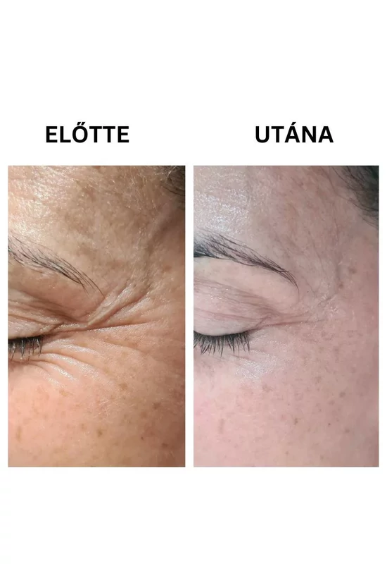 Nagora QUICK FIX szemkörnyékápoló azonnali b.o.t.o.x hatású peptiddel 15ml