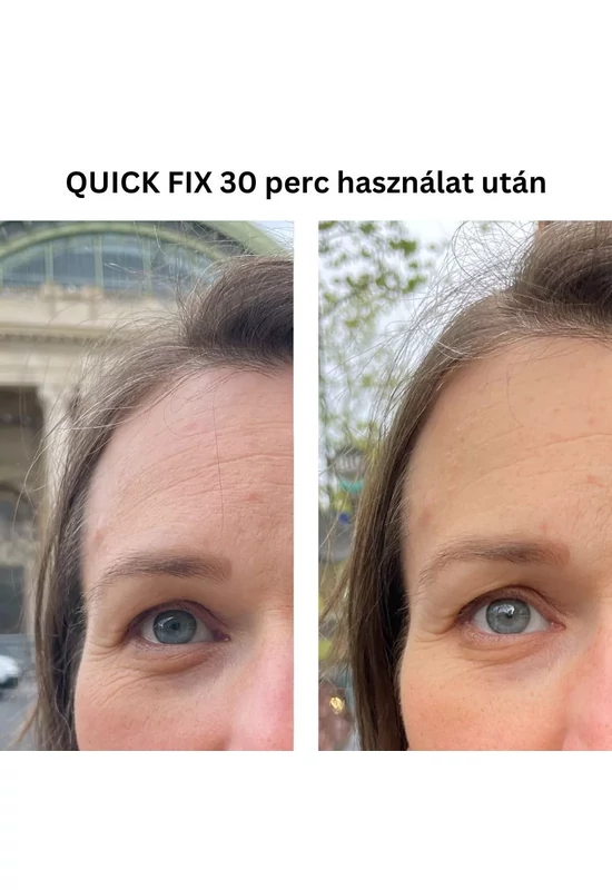 Nagora QUICK FIX szemkörnyékápoló azonnali b.o.t.o.x hatású peptiddel 15ml