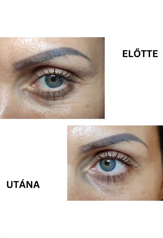 Nagora INSTANT FILLER gyors hatású randiszérum 30ml